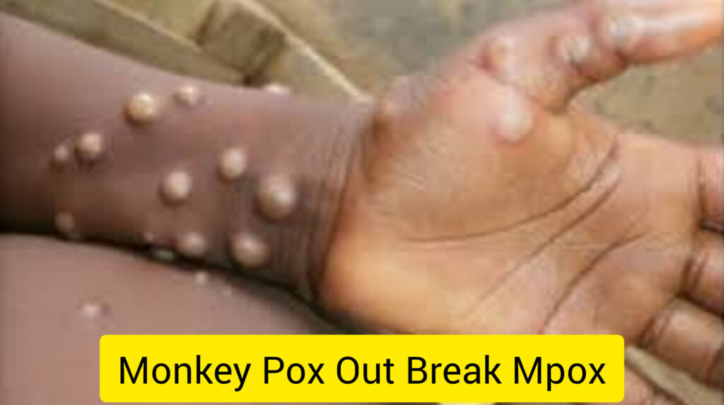 Mpox outbreal